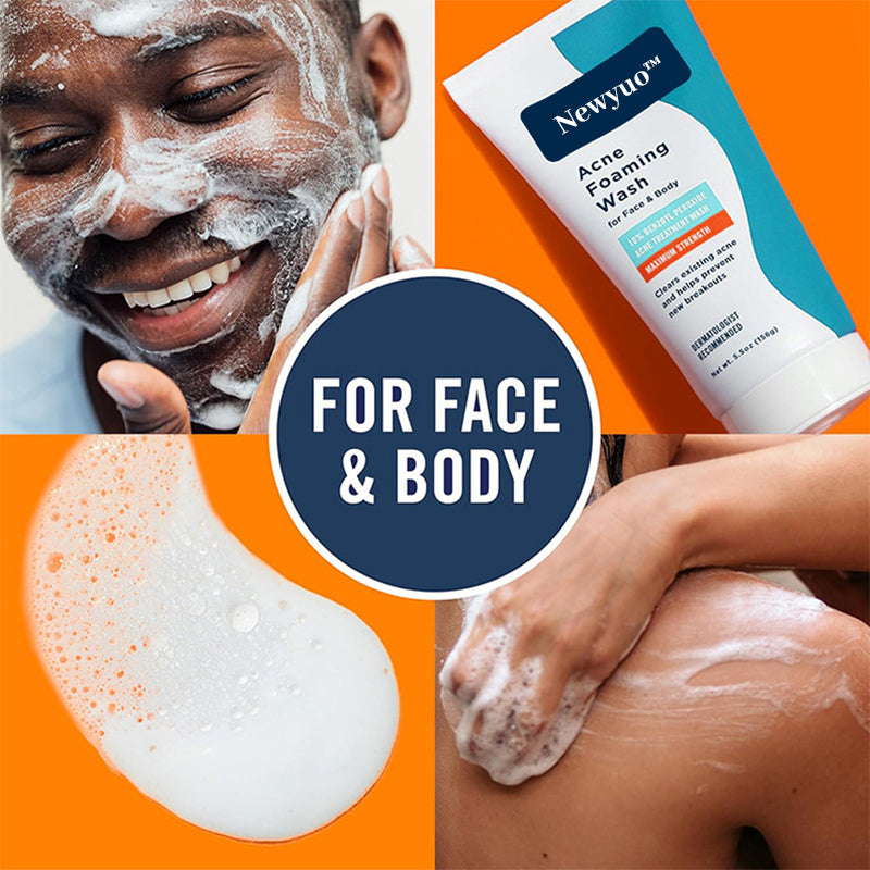 Newyuo™ Acne Foaming Cream Cleanser, 10% Benzoyl Peroxide Face Wash With Hyaluronic Acid, Niacinamide
